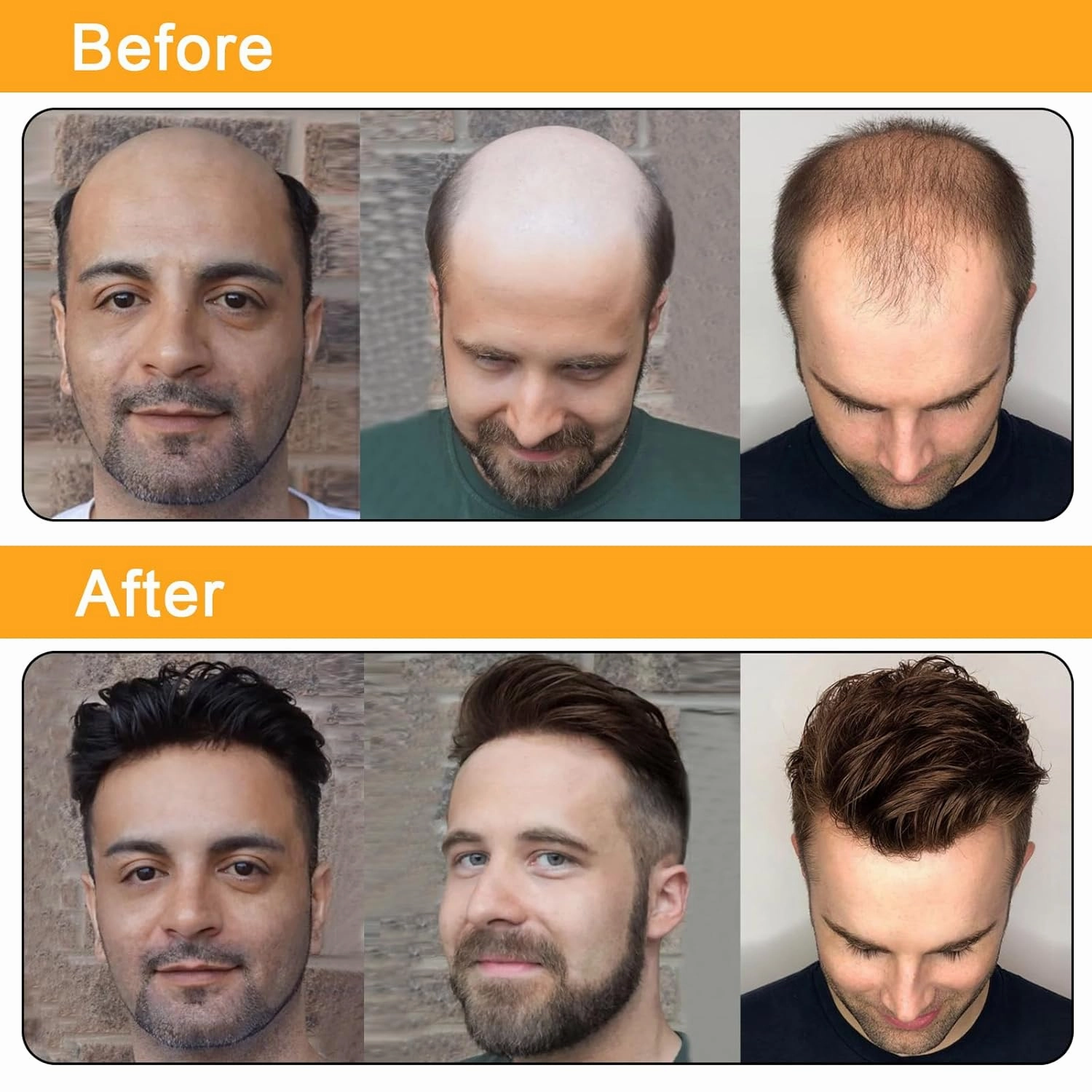 BEEOS 0.06mm Ultra Thin Skin Toupee for Men, V-looped Mens Hair Piece 8x10 Inch PU Base Hair Replacement System #2 Dark Brown