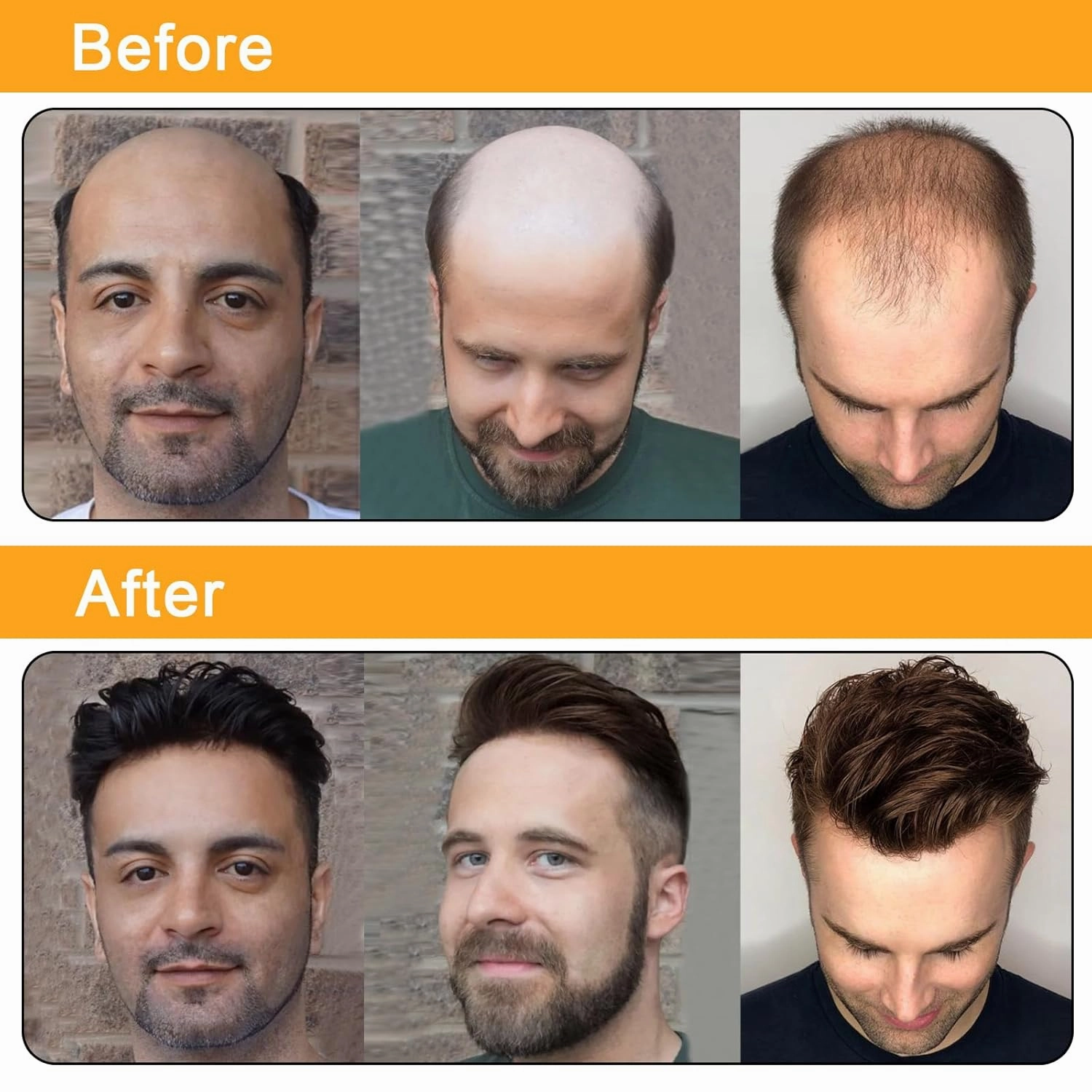 BEEOS 0.08mm Thin Skin Toupee for Men, V-looped No Knots 8x10 Inch PU Base Size Mens Hair Piece, Hair Replacement System #1 Jet Black