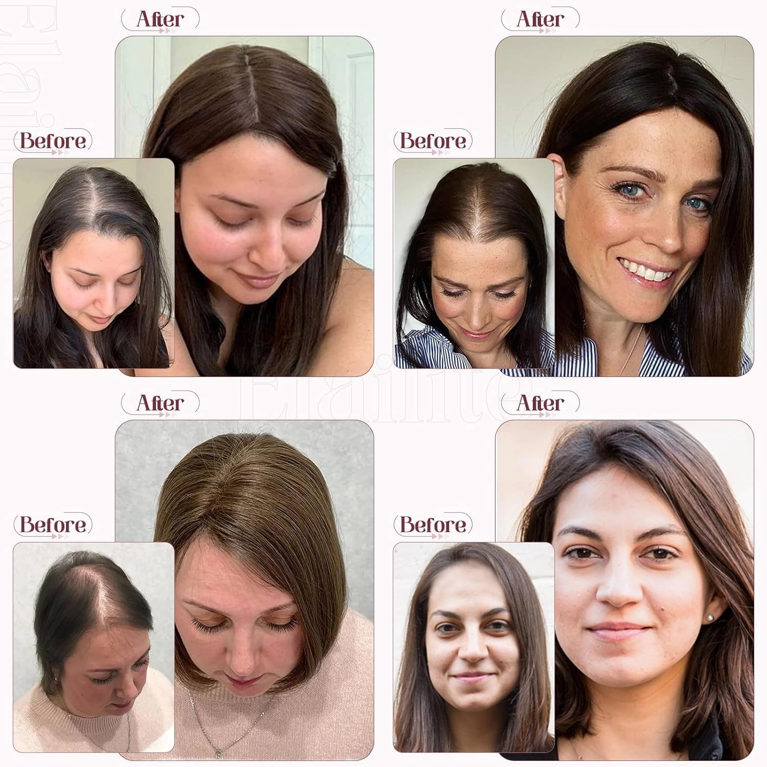 Elailite Hair Toppers for Women Real Human Hair Topper Thinning Thin 5.1"x2.8" Silk Base Clip in Remy Hairpieces 14 Inch Chocolate Brown